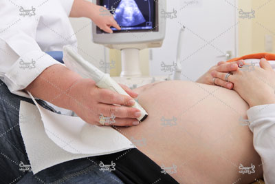 دانلود تصویر خانم باردار در سنوگرافی